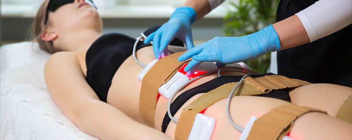 4 types of people who benefit from Lipo Laser