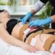 4 types of people who benefit from Lipo Laser