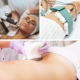 How 3D Lipo Laser effects cellulite and fat reduction
